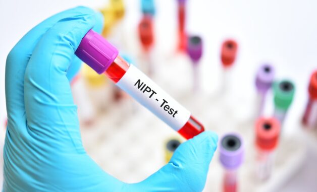 NIPT là phương pháp sàng lọc dựa hoàn toàn vào xét nghiệm ADN của thai nhi trong máu mẹ