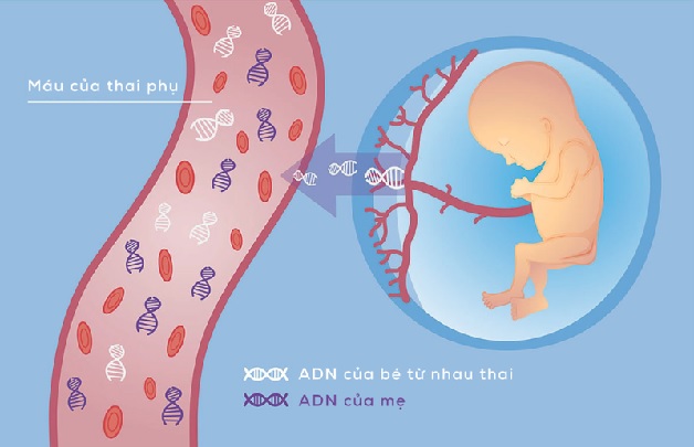 Sàng lọc trước sinh là xét nghiệm quan trọng mẹ bầu nào cũng nên thực hiện
