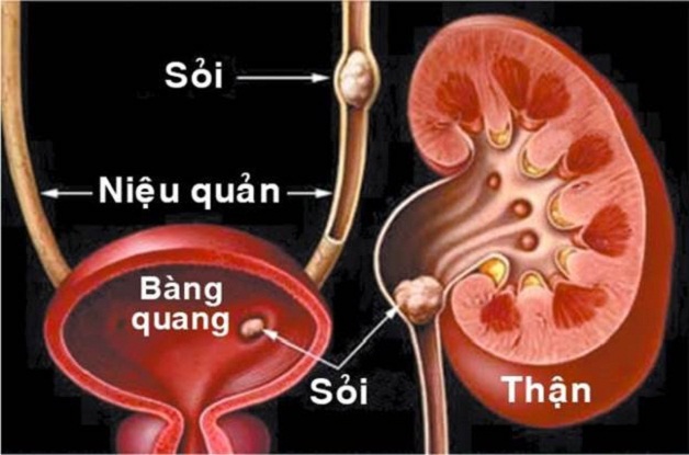 soi xuong bang quang 2