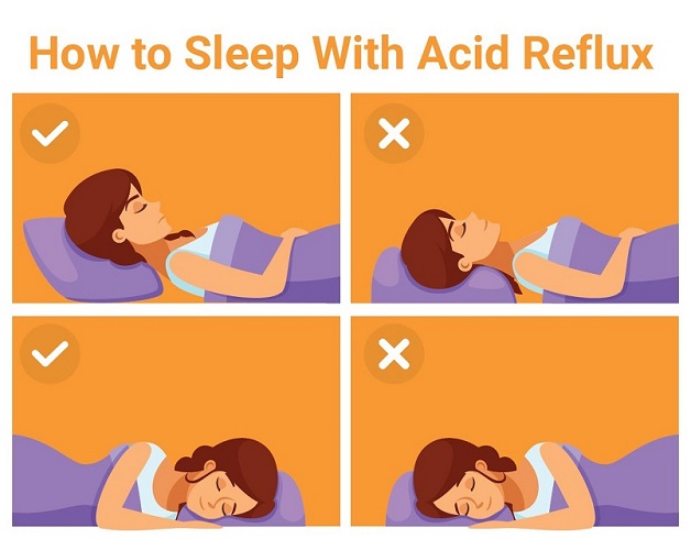 ĐIều chỉnh tư thế nằm để hạn chế tình trạng trào ngược của acid dạ dày lên thực quản khi ngủ.