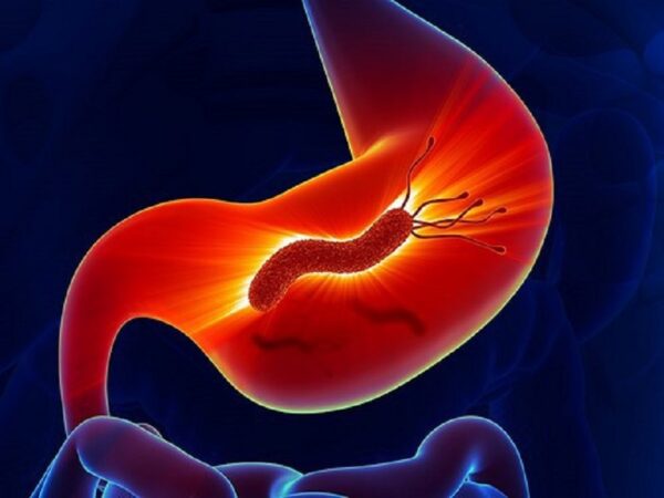 vi khuẩn h.pylori là gì