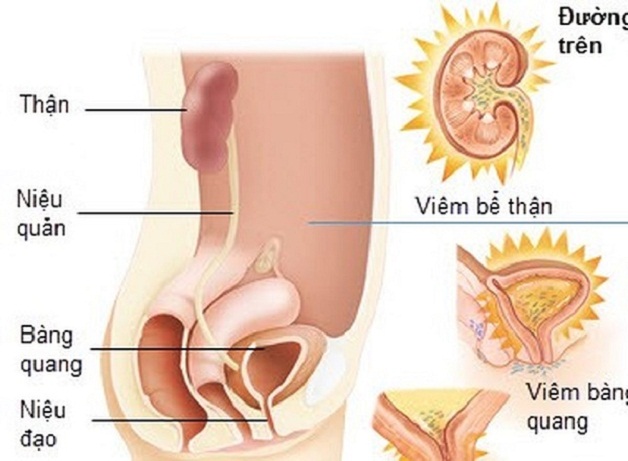 viem duong tiet nieu quan he co lay khong 4