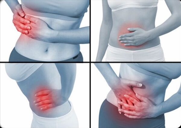 Viêm loét đại tràng và bệnh Crohn là hai loại bệnh viêm ruột ( IBD ) cũng là nguyên nhân gây viêm đại tràng