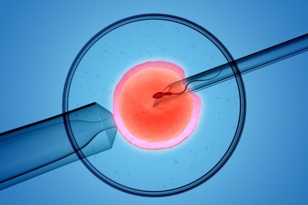 IVF được thực hiện khi trứng kết hợp với tinh trùng ở bên tròng phòng thí nghiệm với những điều kiện môi trường phù hợp
