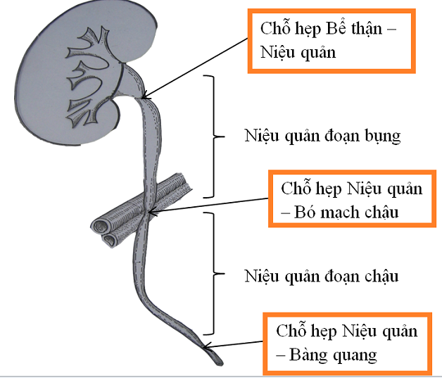 mo tao hinh nieu quan 4