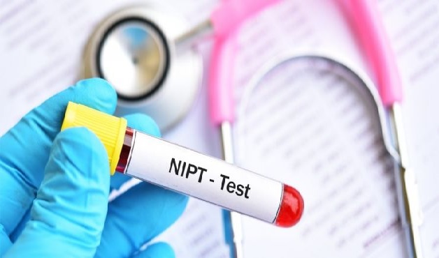 Sai số của xét nghiệm NIPT rất thấp