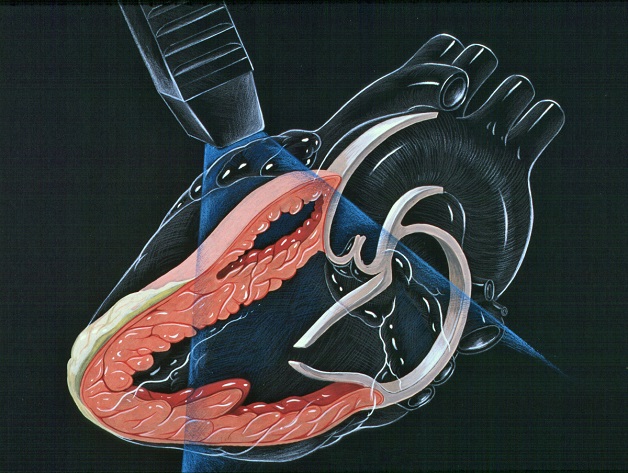 Siêu âm tim sử dụng sóng siêu âm tần số cao để quan sát chuyển động và ghi lại hình ảnh của tim