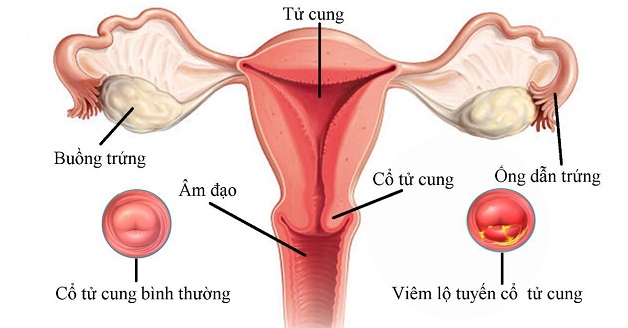 Tử cung có vai trò vô cùng quan trọng trong chu kỳ kinh nguyệt của phụ nữ và quá trình thụ tinh