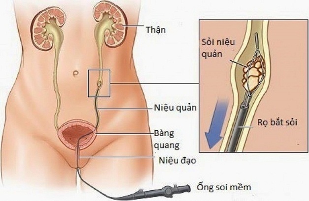 tan soi het bao nhieu tien 3