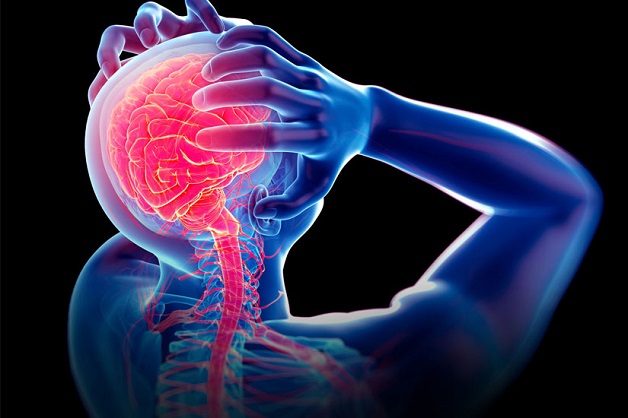 Thiếu máu não là một bệnh rất nguy hiểm và rất hay bị lơ là, bỏ qua. Những người có nguy cơ hoặc đã mắc bệnh này cần chú ý đến vấn đề dinh dưỡng.