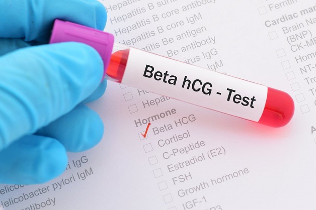 Bệnh nhân được tiến hành lấy máu để xét nghiệm beta HCG