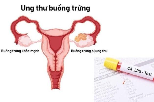 Làm xét nghiệm máu ở đâu tốt