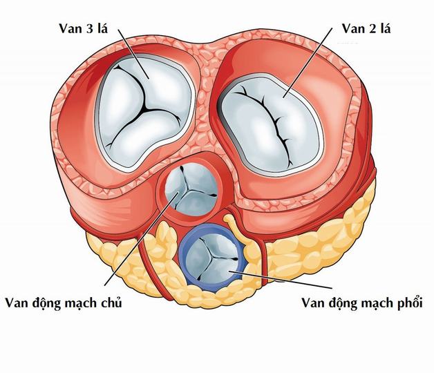 Các loại hẹp van tim 