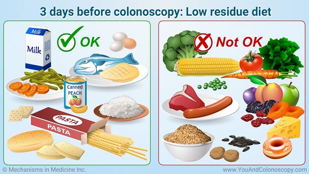 Chế độ ăn chuẩn bị nội soi đại tràng là gì?