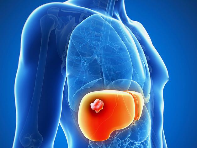 người bị nhiễm virus viêm gan B sống được bao lâu