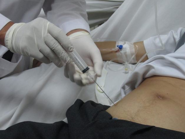phương pháp điều trị xơ gan giai đoạn mất bù 