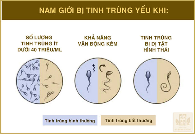Tinh trùng yếu được đánh giá qua ba yếu tố số lượng, hình thái, khả năng vận động.