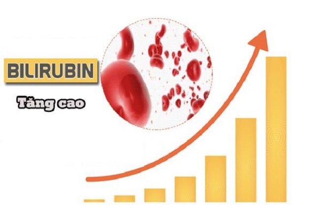 Nguyên nhân chủ yếu dẫn đến hiện tượng vàng da ở trẻ sơ sinh là do máu có nồng độ sắc tố bilirubin cao.