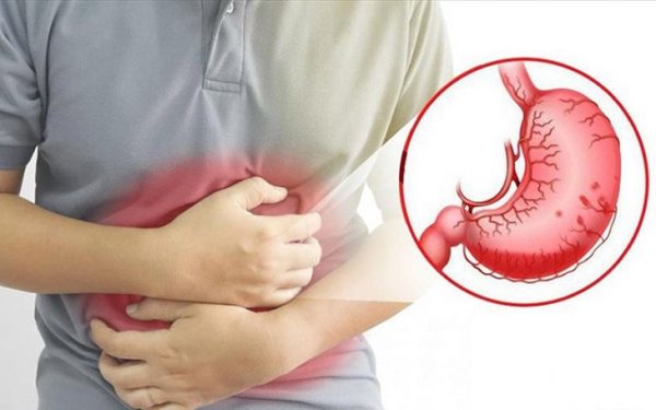Bệnh viêm dạ dày âm tính có thể sử dụng thuốc để điều trị triệu chứng 