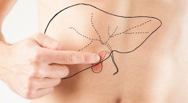 Viêm túi mật điều trị như thế nào? Nguyên nhân, triệu chứng Nguyên nhân chính dẫn đến viêm túi mật đó chính là do sỏi mật