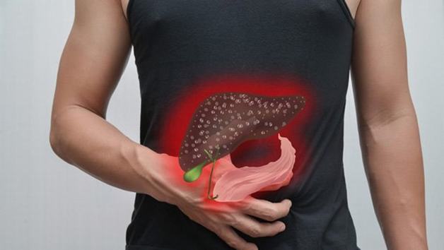 xơ gan ứ mật là gì