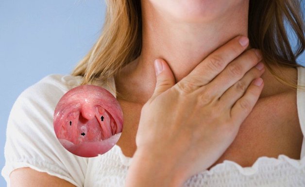 tầm soát ung thư vòm họng là gì