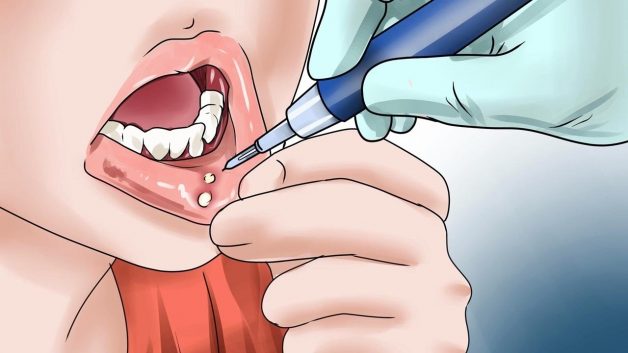 Cần đến bệnh viện thăm khám nếu như tình trạng kéo dài lâu và không có dấu hiệu thuyên giảm