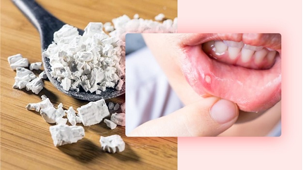 Sử dụng bột sắn dây là một trong những cách chữa nhiệt miệng tại nhà hiệu quả và tiết kiệm