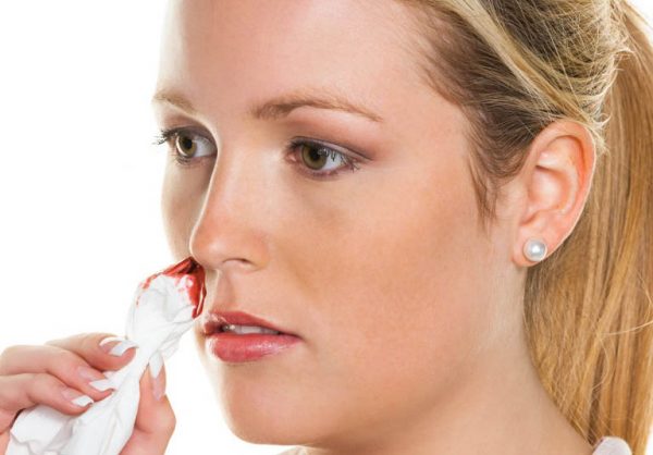 Viêm xoang cấp gây nên nhiều biến chứng