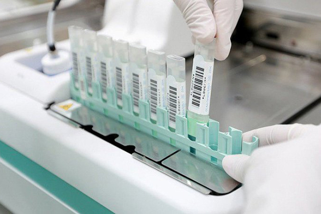 Tầm soát ung thư đại trực tràng qua xét nghiệm máu trong phân