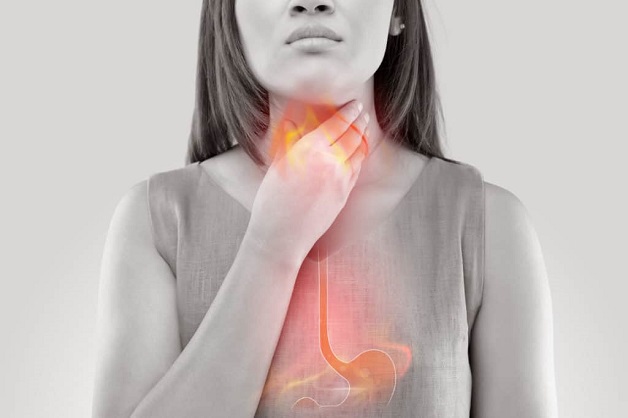 Người bệnh trào ngược dạ dày uống thuốc gì để giảm triệu chứng?