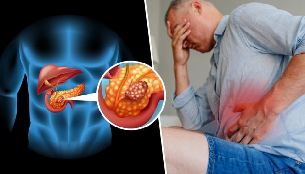 Căn bệnh ung thư tụy có nguy hiểm không?