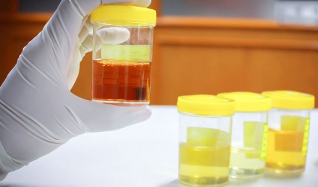 ung thư tụy giai đoạn đầu