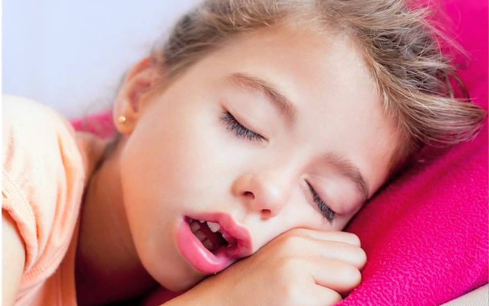 Viêm VA độ 3 khiến trẻ thở bằng miệng nhiều hơn