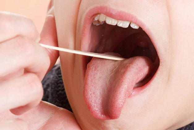 cắt amidan ở đâu