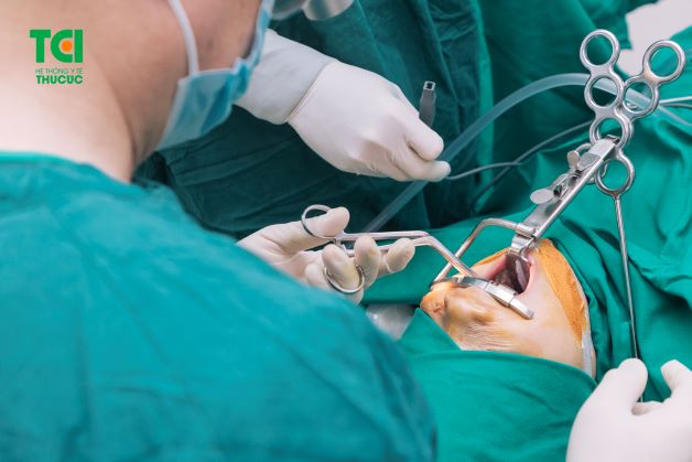 Cắt amidan là giải pháp tối ưu nhằm điều trị viêm amidan tái phát thường xuyên, mãn tính 