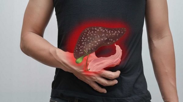 Bệnh viêm túi mật là gì? Nguyên nhân, triệu chứng, điều trị Viêm túi mật là hiện tượng túi mật bị nhiễm trùng