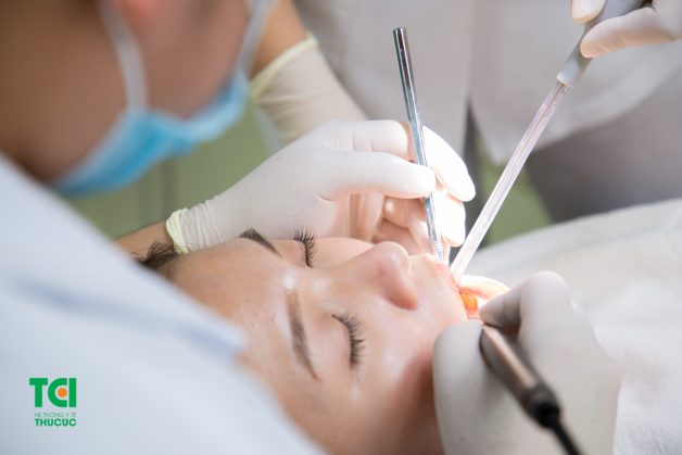 Để có thể dán răng sứ, bác sĩ sẽ thực hiện mài một lớp men răng mỏng