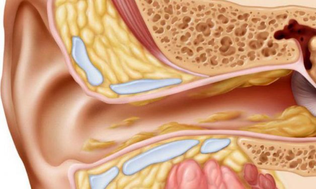 Cơ chế hình thành bệnh viêm tai giữa người lớn