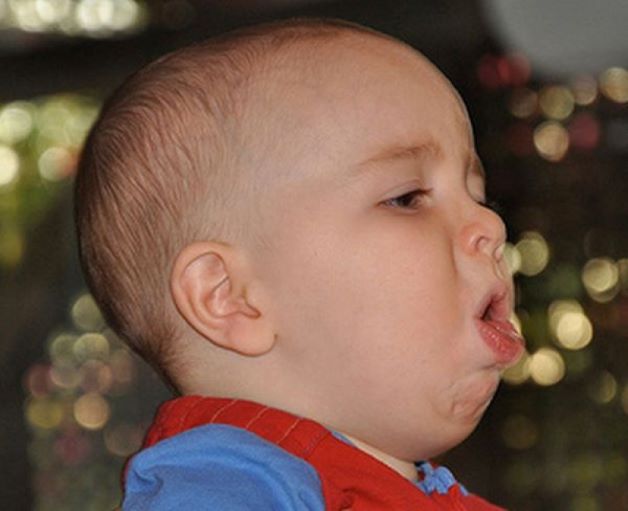Ho gà lây qua đường hô hấp chủ yếu thông qua các giọt bắn nước bọt trong không khí khi người bệnh ho, hắt hơi, sổ mũi