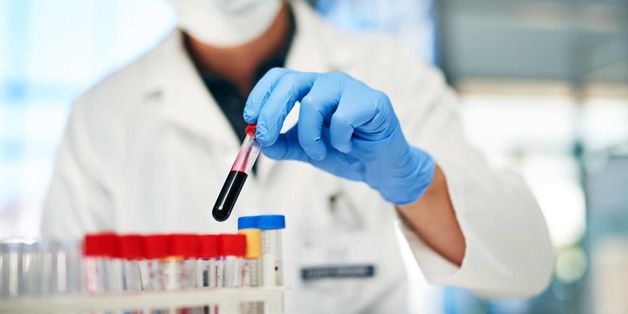 xét nghiệm huyết học ở đâu