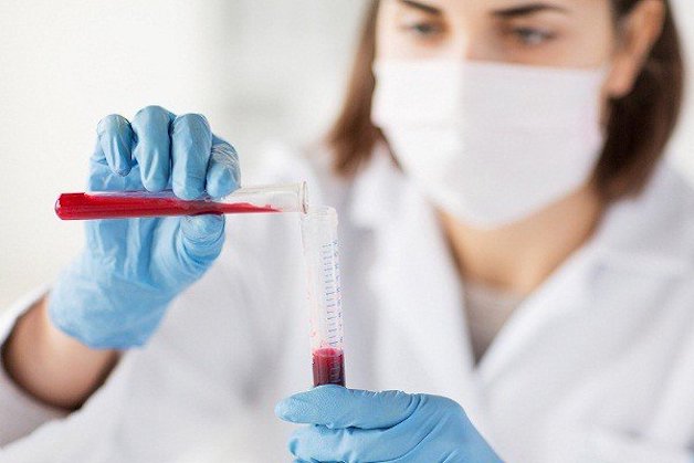 lưu ý khi xét nghiệm Anti Tg