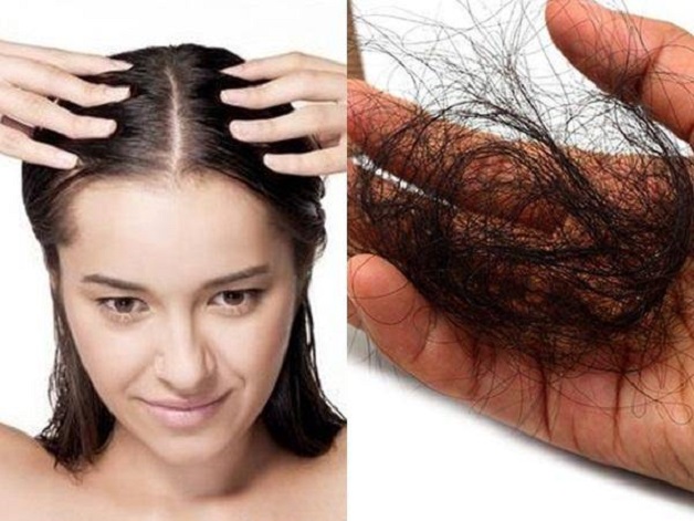 Thiếu máu não có gây rụng tóc không là thắc mắc của rất nhiều người