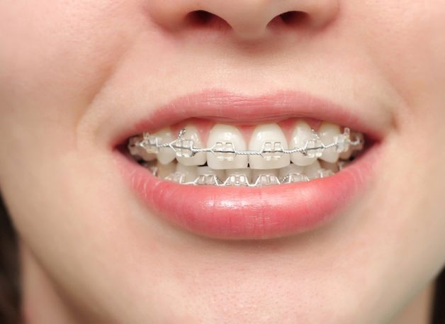 nguyên nhân nhiệt miệng ở má trong