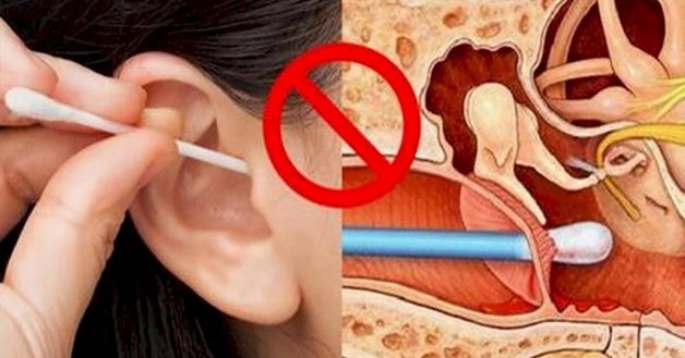 Tìm hiểu trước khi vá màng nhĩ