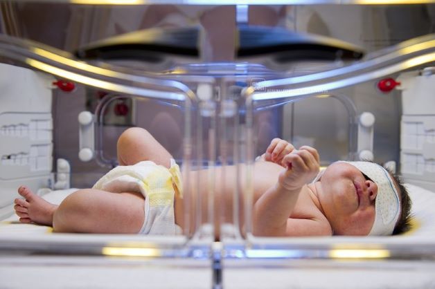 Quang trị là một trong những phương pháp điều trị vàng da hiệu quả và an toàn hiện nay