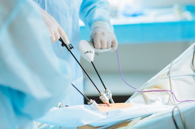Giải đáp tắc ruột có phải mổ không