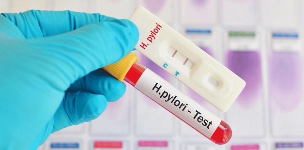 Xét nghiệm máu test vi khuẩn HP không được ưu tiên thực hiện
