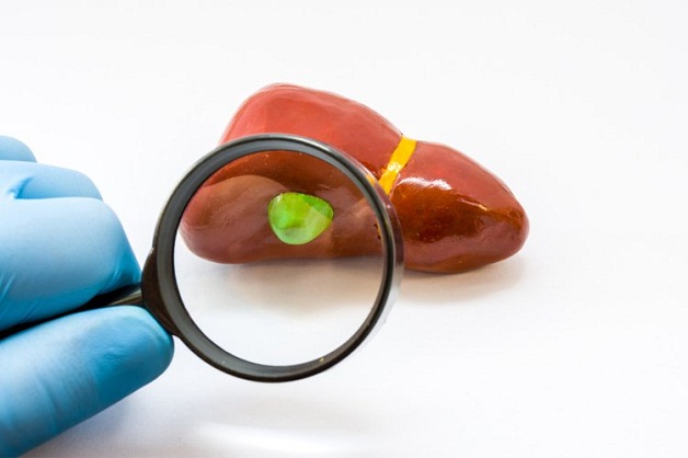 Túi mật có polyp có thể điều trị bảo tồn hoặc phẫu thuật tùy thuộc vào kích thước khối polyp và các biến chứng đi kèm
