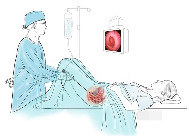 Tìm hiểu viêm đường tiết niệu cần xét nghiệm gì rất cần thiết cho việc điều trị